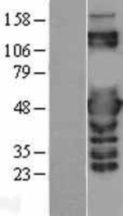Novus Biologicals&trade;&nbsp;PSMC3 Overexpression Lysate