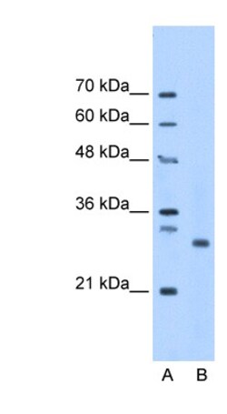 PSMC3IP Antibody, Novus Biologicals:Antibodies:Primary Antibodies