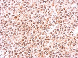 PSMC6 Antibody, Novus Biologicals 0.1mL; Unlabeled:Antibodies, Polyclonal