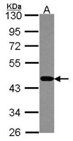 PSMC6 Antibody, Novus Biologicals 0.1mL; Unlabeled:Antibodies, Polyclonal