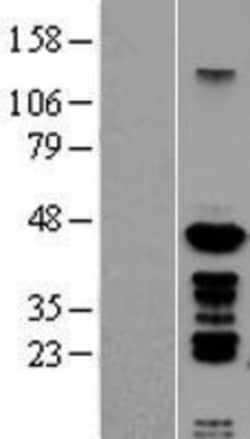 Novus Biologicals&trade;&nbsp;PSMC6 Overexpression Lysate