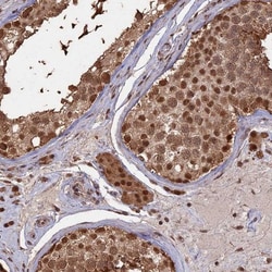 PSMC6 Antibody, Novus Biologicals 25 &mu;L, Unlabeled:Antibodies, Polyclonal