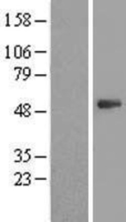 Novus Biologicals&trade;&nbsp;PSMD11 Overexpression Lysate