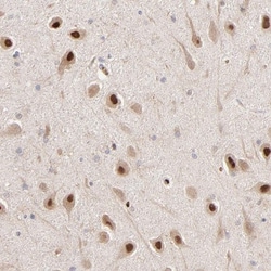 PSMD14 Antibody, Novus Biologicals:Antibodies:Primary Antibodies