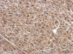 PSMD6 Antibody, Novus Biologicals 0.1mL; Unlabeled:Antibodies, Polyclonal