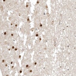 PSMD6 Antibody, Novus Biologicals 0.1mL; Unlabeled:Antibodies, Polyclonal