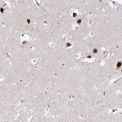 PSMD7 Antibody, Novus Biologicals 25 &mu;L, Unlabeled:Antibodies, Polyclonal