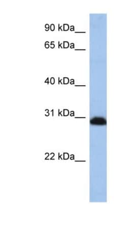 PSMD8 Antibody, Novus Biologicals 100 &mu;L | Buy Online | Novus Biologicals | Fisher Scientific