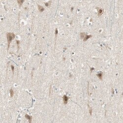 PSMD8 Antibody, Novus Biologicals 0.1mL; Unlabeled:Antibodies, Polyclonal