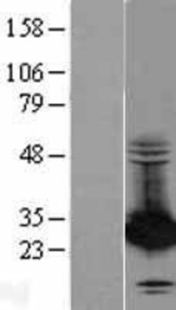 Novus Biologicals&trade;&nbsp;PA28 Activator beta Subunit/PSME2 Overexpression Lysate