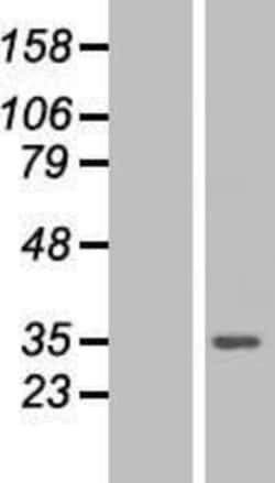 Novus Biologicals&trade;&nbsp;PA28 Activator gamma Subunit/PSME3 Overexpression Lysate