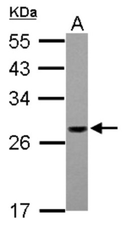 PSMG1 Antibody, Novus Biologicals 0.1mL; Unlabeled:Antibodies, Polyclonal