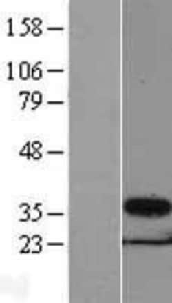 Novus Biologicals&trade;&nbsp;PSMG1 Overexpression Lysate