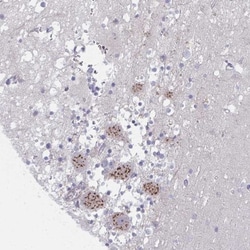 PSMG1 Antibody, Novus Biologicals 0.1mL; Unlabeled:Antibodies, Polyclonal