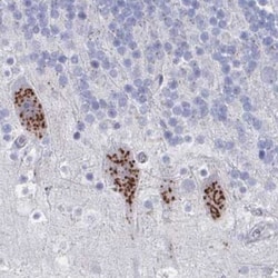PSMG1 Antibody, Novus Biologicals 0.1mL; Unlabeled:Antibodies, Polyclonal