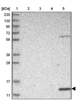 PSMG3 Antibody, Novus Biologicals 0.1mL; Unlabeled:Antibodies, Polyclonal