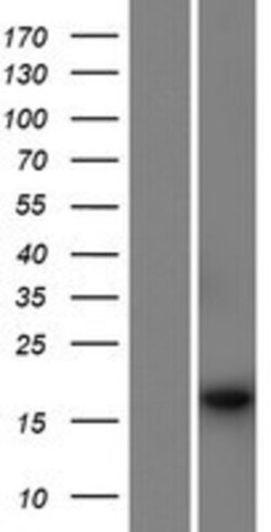 Novus Biologicals&trade;&nbsp;PSMG4 Overexpression Lysate