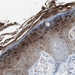 S100A7/Psoriasin Antibody, Novus Biologicals 25 &mu;L; Unlabeled:Antibodies,