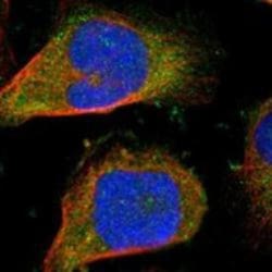 S100A7/Psoriasin Antibody, Novus Biologicals 25 &mu;L; Unlabeled:Antibodies,