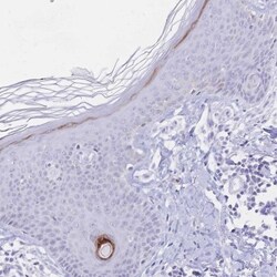 PSORS1C2 Antibody, Novus Biologicals 0.1mL; Unlabeled:Antibodies, Polyclonal