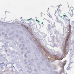 PSORS1C2 Antibody, Novus Biologicals 0.1mL; Unlabeled:Antibodies, Polyclonal