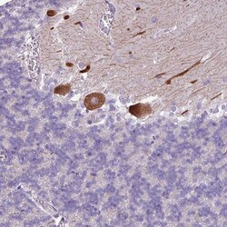 PSRC1 Antibody, Novus Biologicals:Antibodies:Primary Antibodies
