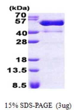 Novus Biologicals&trade;&nbsp;Recombinant Human PSTPIP1 His Protein