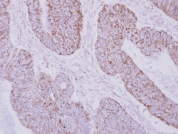PSTPIP2 Antibody, Novus Biologicals 0.1mL; Unlabeled:Antibodies, Polyclonal