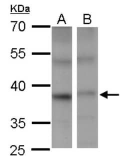 PSTPIP2 Antibody, Novus Biologicals 0.1mL; Unlabeled:Antibodies, Polyclonal