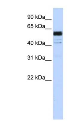 PTBP1 Antibody, Novus Biologicals 0.05mg; Unlabeled:Antibodies, Polyclonal