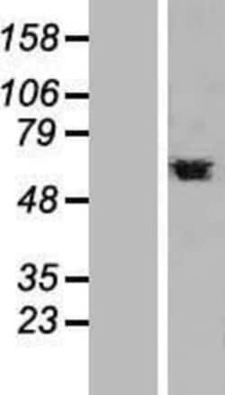 Novus Biologicals&trade;&nbsp;PTBP1 Overexpression Lysate