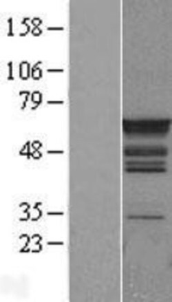 Novus Biologicals&trade;&nbsp;PTBP1 Overexpression Lysate