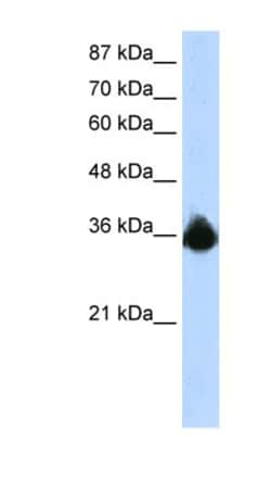 PTBP2 Antibody, Novus Biologicals:Antibodies:Primary Antibodies