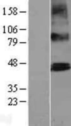 Novus Biologicals&trade;&nbsp;PTCD2 Overexpression Lysate
