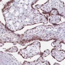 PTCHD1 Antibody, Novus Biologicals:Antibodies:Primary Antibodies