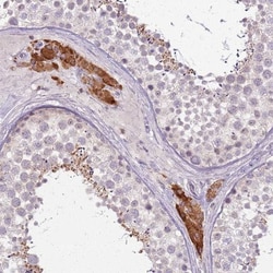 PTCHD3 Antibody, Novus Biologicals:Antibodies:Primary Antibodies