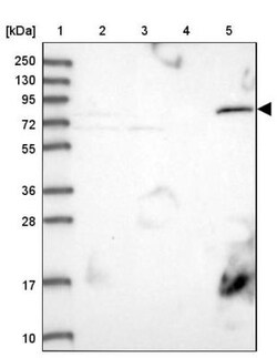 PTCHD3 Antibody, Novus Biologicals:Antibodies:Primary Antibodies