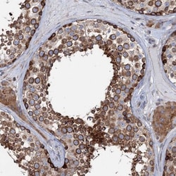 PTDSS2 Antibody, Novus Biologicals 0.1mL; Unlabeled:Antibodies, Polyclonal