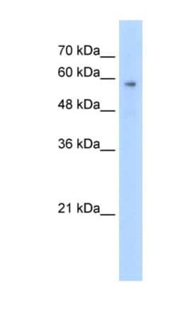 PTEN2/TPTE Antibody, Novus Biologicals 100&mu;L; Unlabeled:Antibodies,