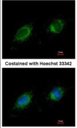 PTER Antibody, Novus Biologicals 0.1mL; Unlabeled:Antibodies, Polyclonal