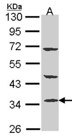 PTER Antibody, Novus Biologicals 0.1mL; Unlabeled:Antibodies, Polyclonal
