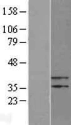 Novus Biologicals™ PTER Overexpression Lysate