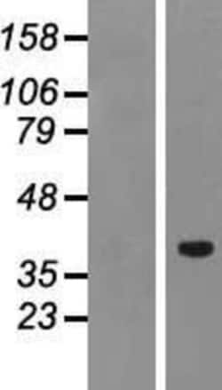 Novus Biologicals™ PTF1A Overexpression Lysate