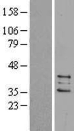 Novus Biologicals&trade;&nbsp;Prostaglandin E Synthase 2/PTGES2 Overexpression Lysate