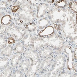 PTH1R/PTHR1 Antibody, Novus Biologicals:Antibodies:Primary Antibodies