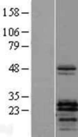 Novus Biologicals&trade;&nbsp;PTHLH/PTHrP Overexpression Lysate