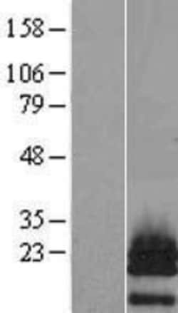 Novus Biologicals&trade;&nbsp;PTHLH/PTHrP Overexpression Lysate