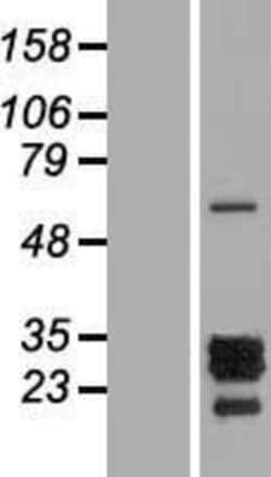 Novus Biologicals&trade;&nbsp;PTHLH/PTHrP Overexpression Lysate