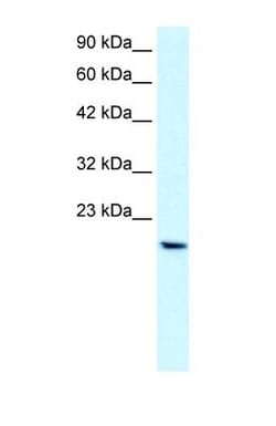 PTHLH/PTHrP Antibody, Novus Biologicals 0.1mg; Unlabeled:Antibodies, Polyclonal