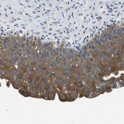 PTK9 Antibody, Novus Biologicals 25 &mu;L | Buy Online | Novus Biologicals | Fisher Scientific